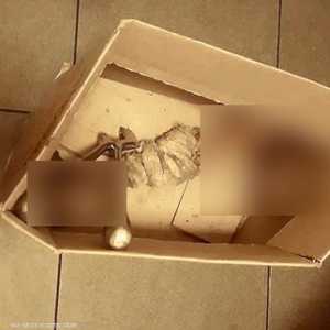 القدم بترت نتيجة عملية جراحية