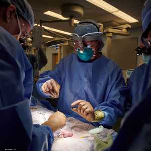 الفريق الجراحي أثناء عملية زراعة الكلية في جسم المريضة