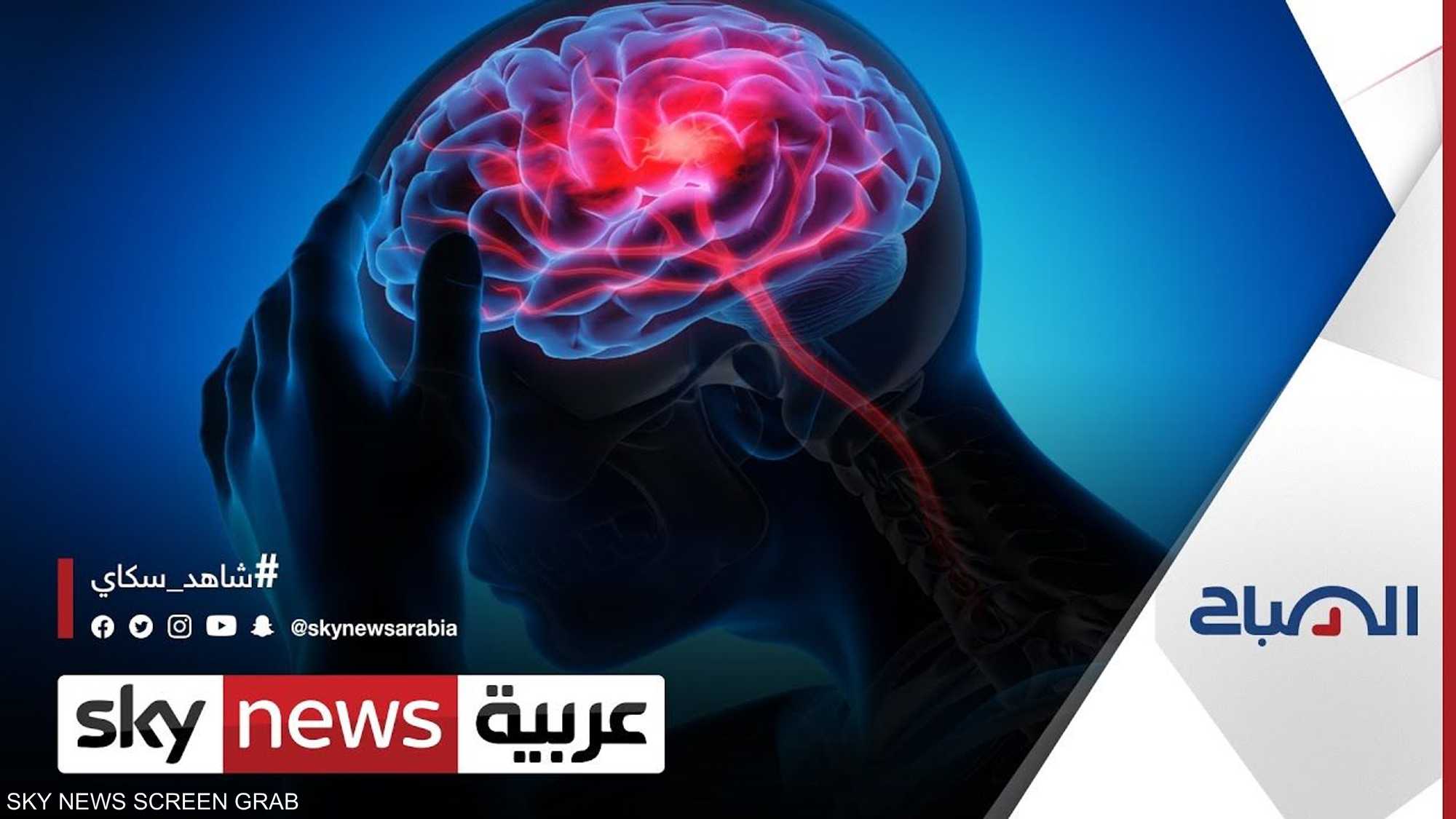 ما هي دلالات السكتة الدماغية؟