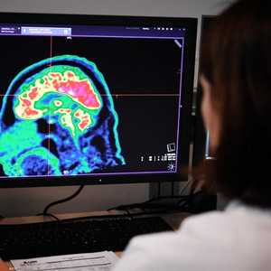 أرشيفية لصورة دماغ بشري