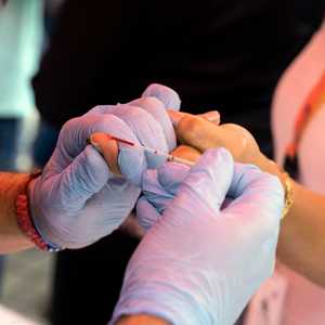 مرض الإيدز يضعف مناعة الإنسان