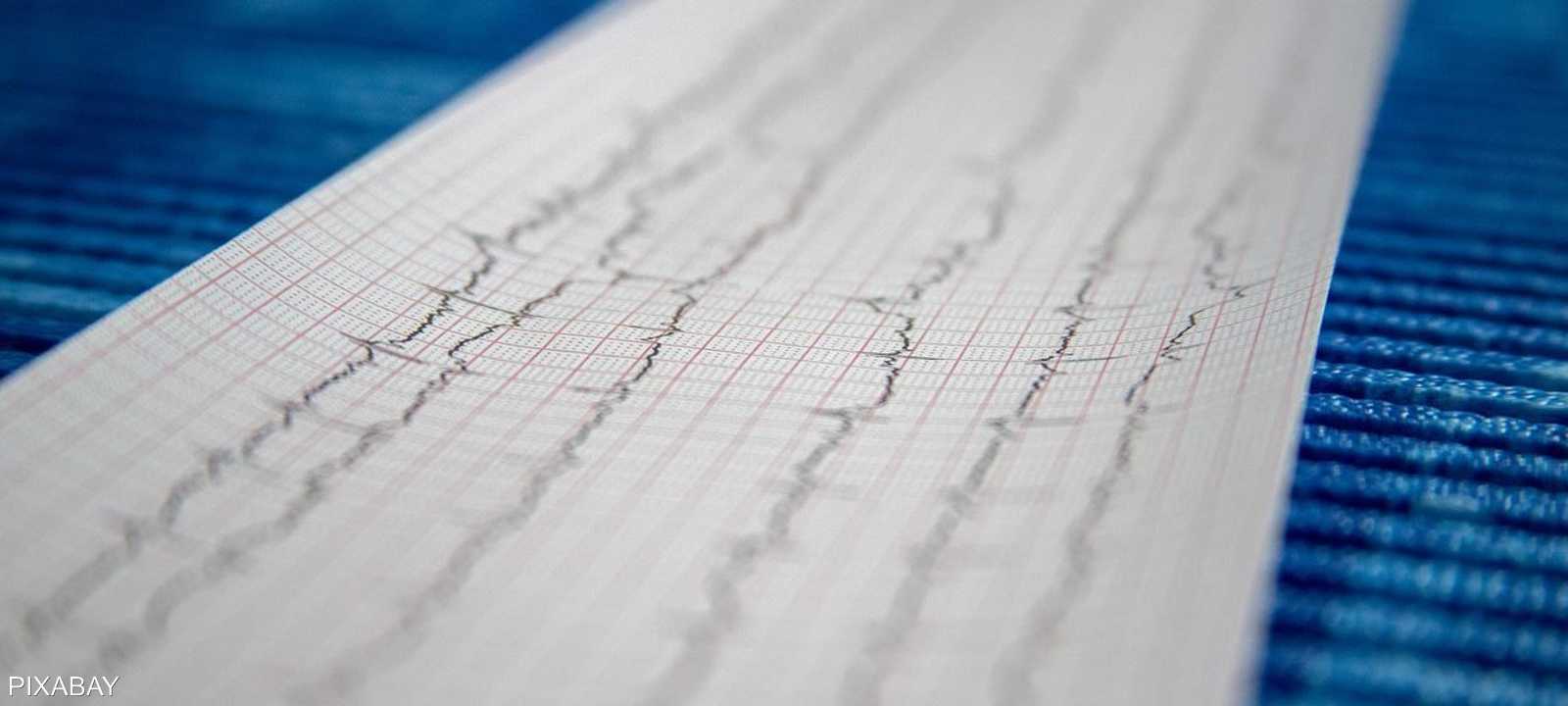أمراض القلب وتصلب الشرايين ترتبط بالكوليسترول الضار
