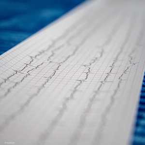 أمراض القلب وتصلب الشرايين ترتبط بالكوليسترول الضار