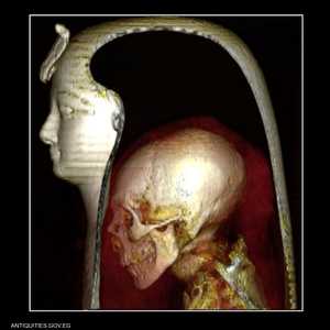 مومياء أمنحتب الأول أثناء التصوير بالأشعة المقطعية