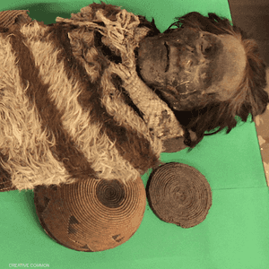 العلماء استخلصوا معلومات هائلة من آثار قمل الرأس