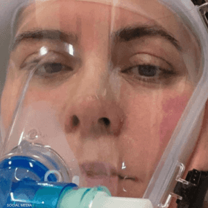 الممرضة عانت أعراضا شديدة بسبب كورونا