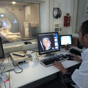 يصاب عدد من مرضى كورونا بضباب الدماغ