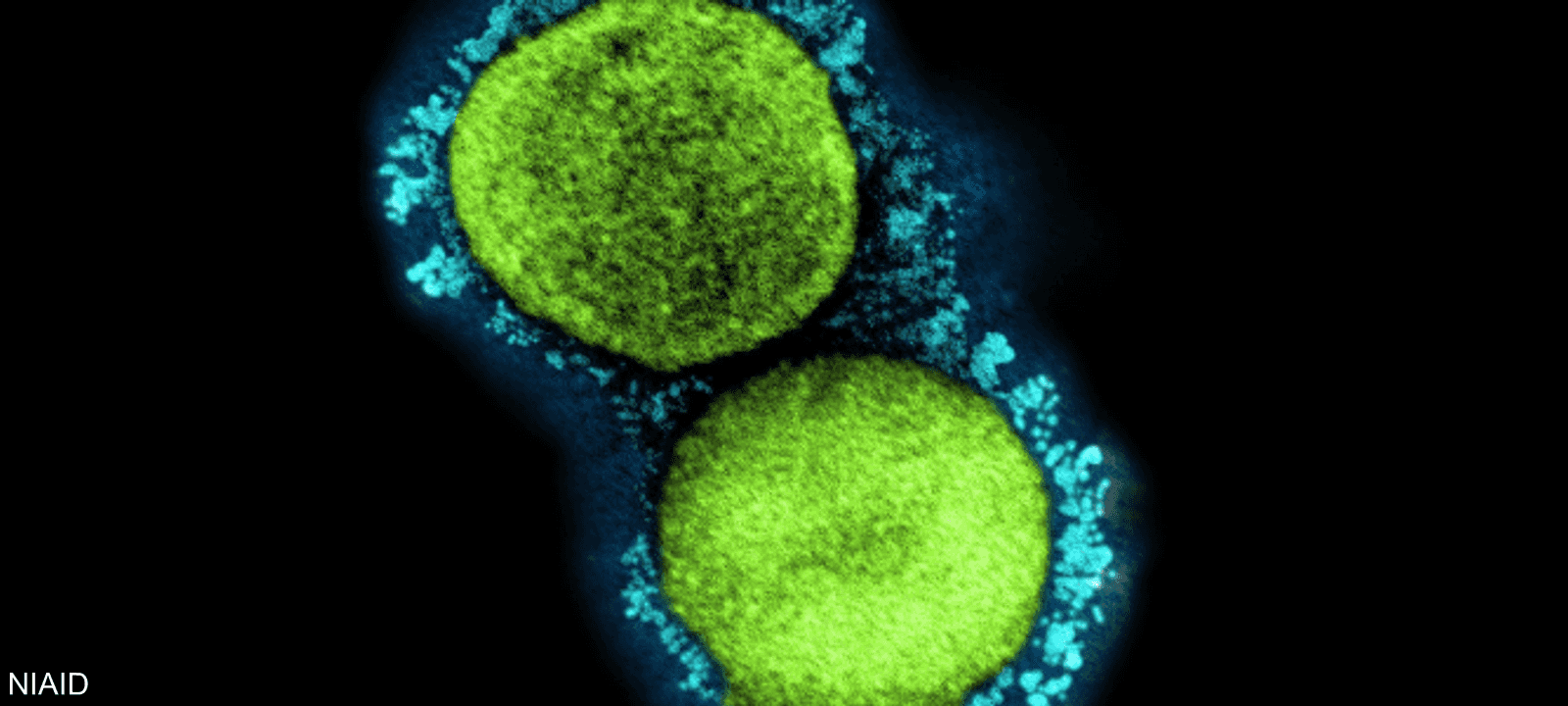 جزيئات فيروس كورونا