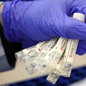 قابلية انتشار السلالة الشبح قد تكون أكثر مرة ونصف من سابقتها