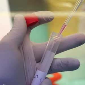 أوميكرون الشبح معدية بأكثر من مرة ونصف من الأصلية