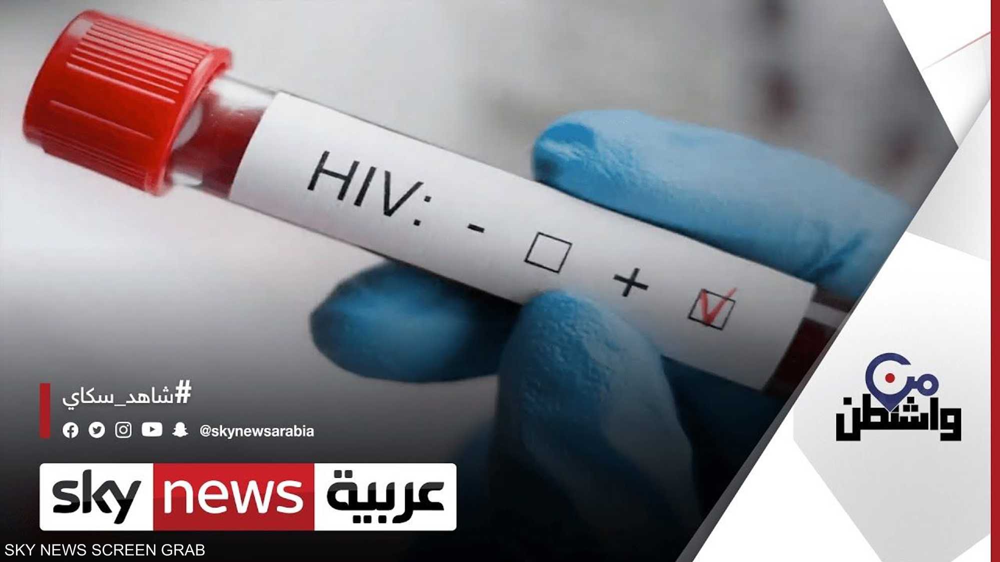 شفاء أول امرأة من فيروس "الإيدز" بعد زراعة خلايا جذعية