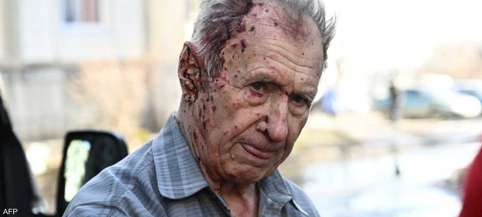 رجل أوكراني أصيب خلال قصف روسي على بلدة تشوغويف شرقي البلاد.