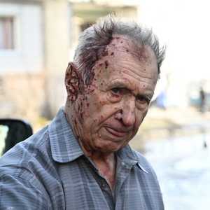 رجل أوكراني أصيب خلال قصف روسي على بلدة تشوغويف شرقي البلاد.