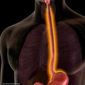 عسر بلع الطعام قد يشير إلى مشكلة كبيرة