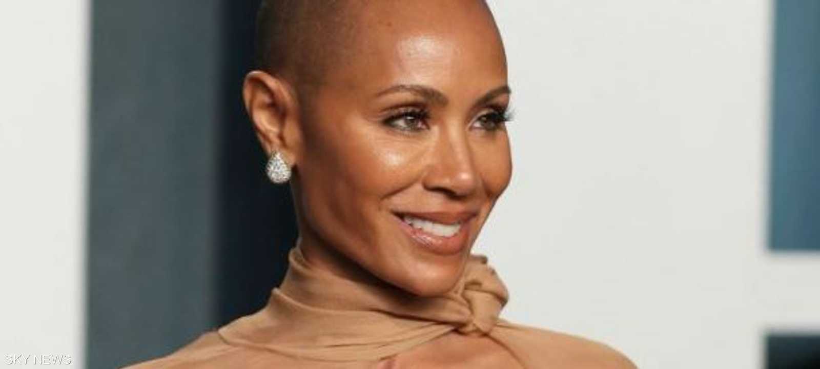 جادا سميث تعاني من داء الثعلبة.