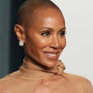 جادا سميث تعاني من داء الثعلبة.