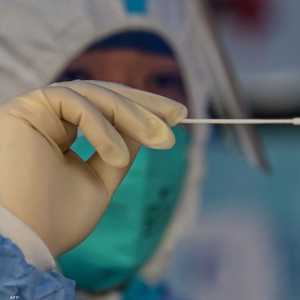 كوفيد طويل الأمد يثير قلق الأطباء