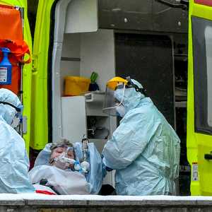 العلماء يبحثون عن سبب الالتهاب الكبدي الغامض