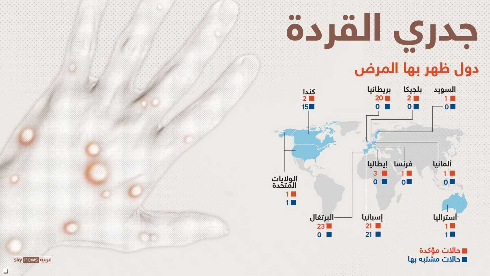 دول ظهر بها جدري القردة