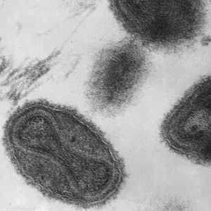 فيروس الجدري الذي يصيب البشر