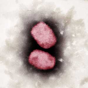 صورة ميكروسكوبية لفيروس جدري القرود