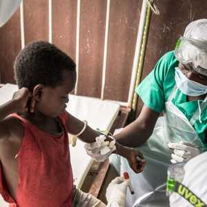 يسعى يحاول العلماء لفهم مصدر الحالات المصابة بجدري القردة