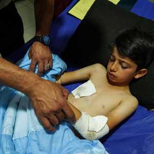 طفل أصيب خلال القصف.