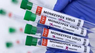 عينات فحص لفيروس جدري القرود