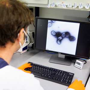 يسابق العلماء الزمن لكشف سبب انتشار جدري القردة..أرشيفية