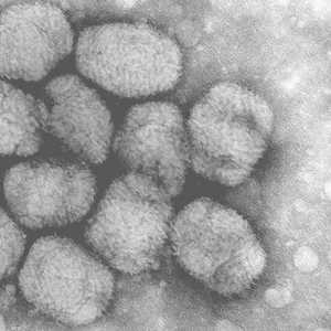 جدري القرود إصابة فيروسية تكون خفيفة عادة.