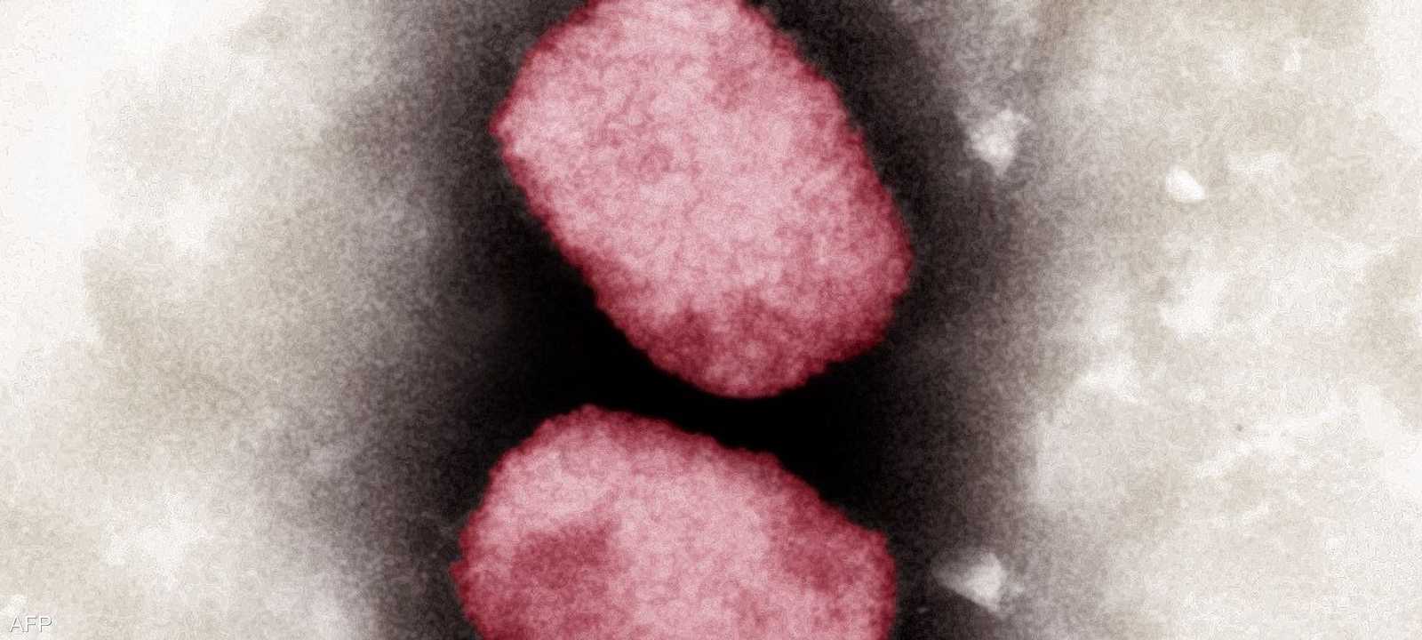 المملكة المتحدة تسجل أكبر انتشار للمرض خارج إفريقيا