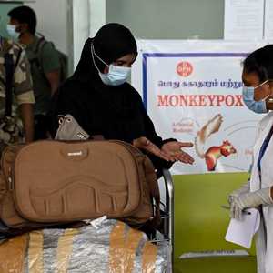 تم تسجيل ألف إصابة بجدري القرود