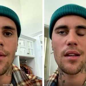 بيبر قال إنه يعاني شللا نصفيا