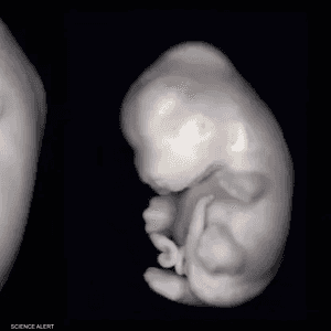 حمض الفالبرويك يرفع خطر إصابة الأجنة بالتشوه