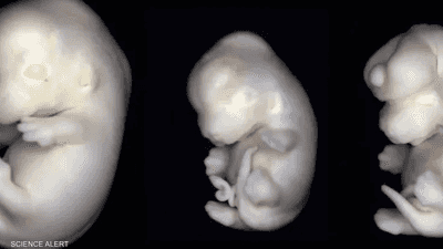 حمض الفالبرويك يرفع خطر إصابة الأجنة بالتشوه