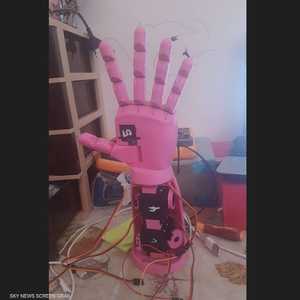 مبتكرا اليد يريدان إيصالها لغير القادرين ماديا