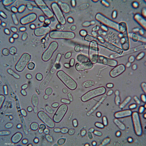 الفيروسات قادرة على البقاء حية تحت الماء بواسطة البلاستيك