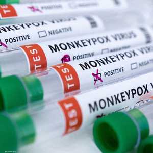 الإصابات بجدري القردة تخطت 10 آلاف حالة