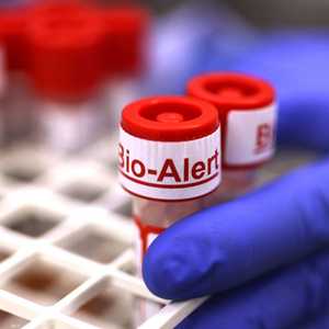 عينة مختبر تحوي فيروس جدري القرود