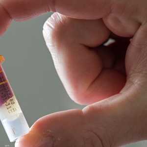 الفحص يمتاز بدقة عالية.. أرشيفية