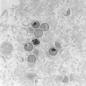 صورة مجهرية لفيروس جدري القردة