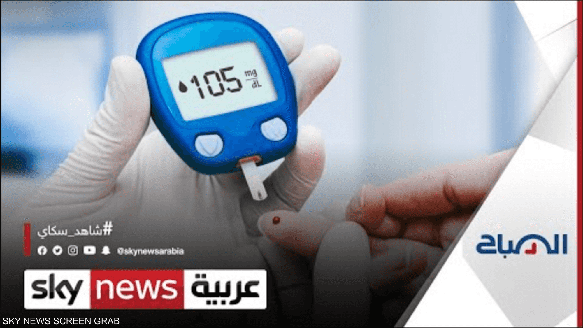طلاب مصريون يطورون جهازا لفحص مستوى السكر بالدم بدون وخزا