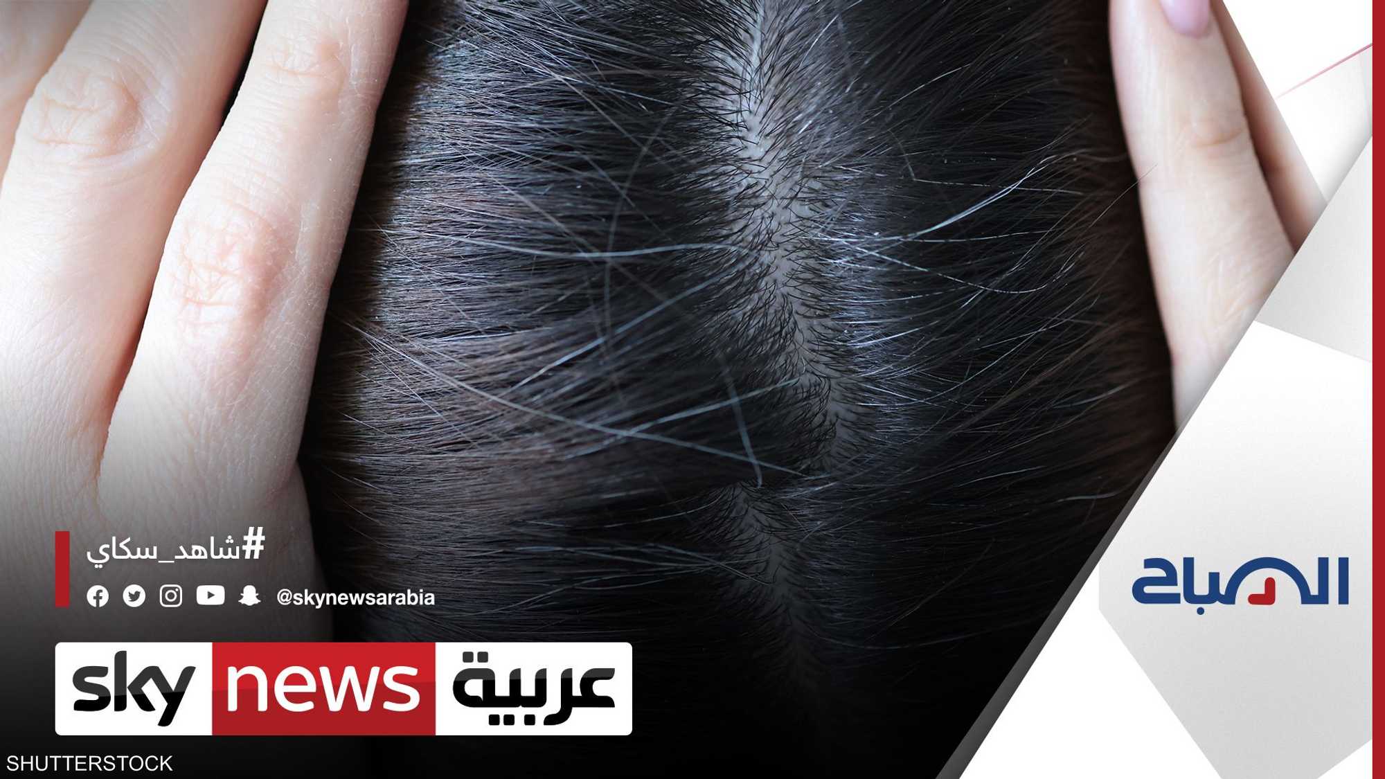 دراسة: يمكن قياس الإجهاد لدى الفرد عبر رصد حالة شعره