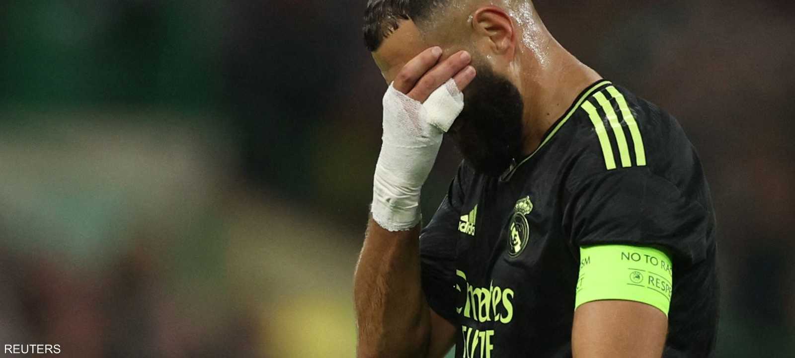 بنزيمة غادر الملعب في الدقيقة 30