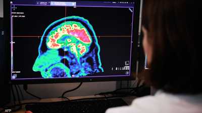 دراسة: كورونا يزيد خطر التعرض لاعتلالات دماغية طويلة الأمد