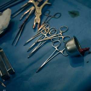 أرشيفية.. العملية استغرقت ساعة كاملة