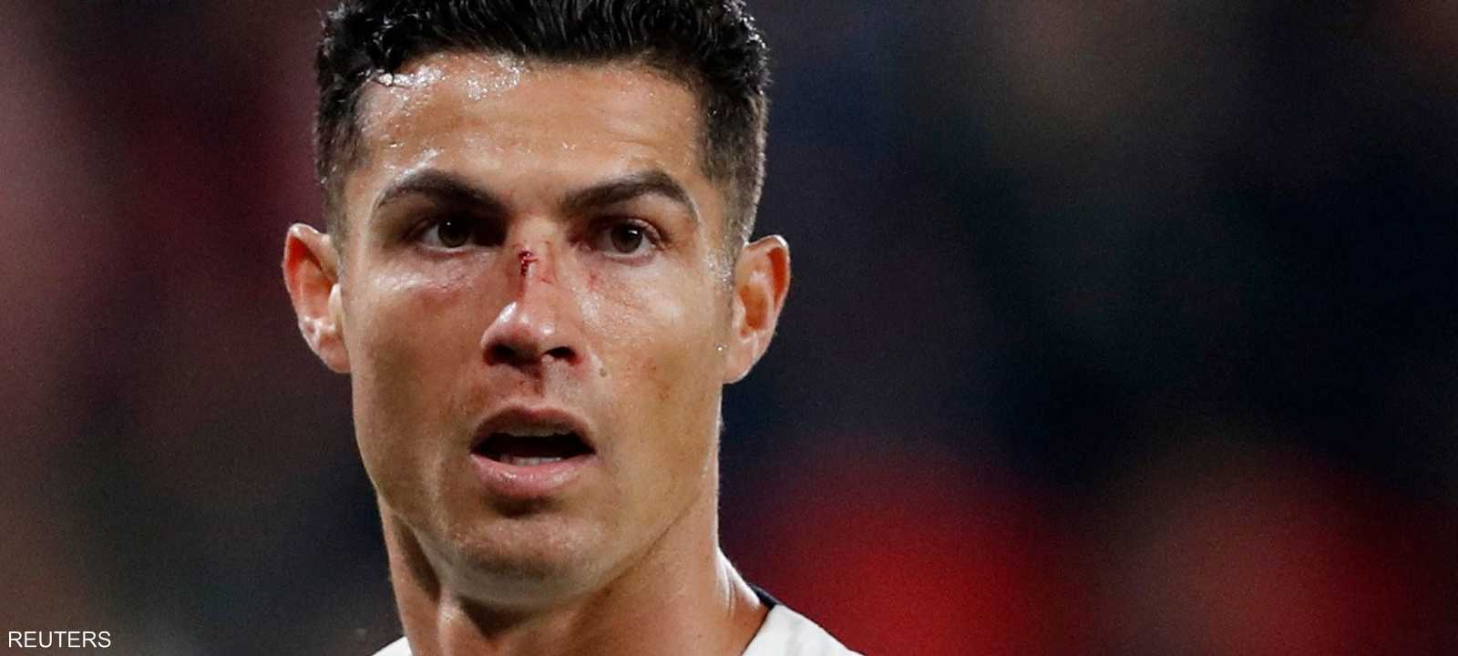 النجم البرتغالي كريستيانو رونالدو