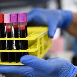 أزمة الدم بليبيا تفاقمت خلال الأشهر الأخيرة