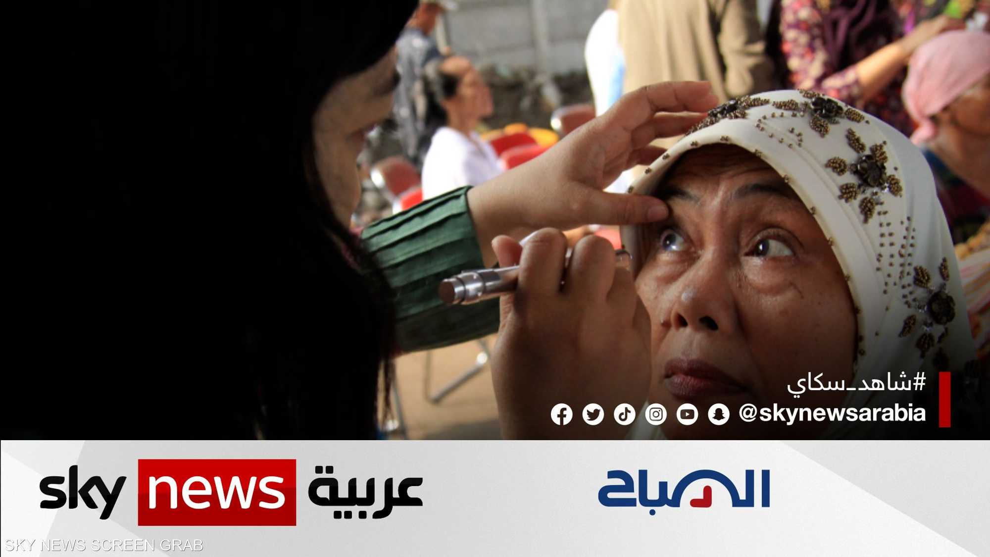 13 أكتوبر.. منظمات تُحيي اليوم الدولي للإبصار