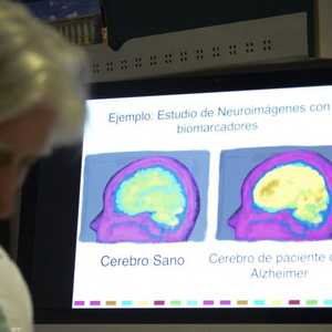 الموسيقى تستخدم لتنشيط ذاكرة المصابين بالألزهايمر..أرشيفية